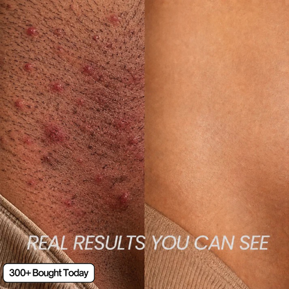 Anti - Hair Growth Oil